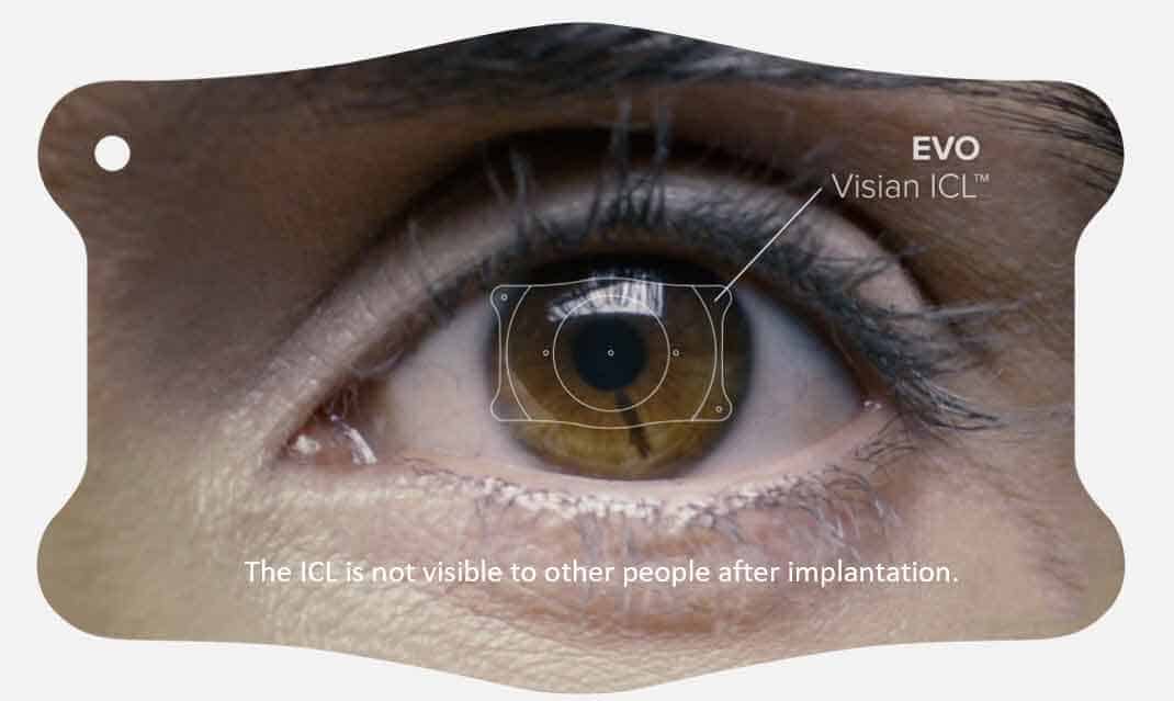 EVO Visian® Implantable Collamer® Lens Receives FDA Approval, Now Available to Treat Myopia in Kansas City