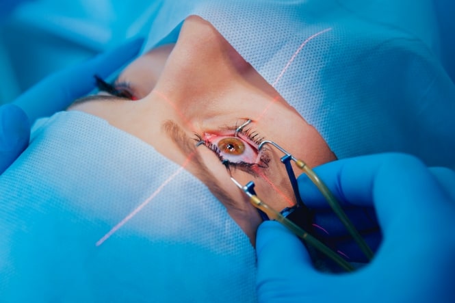 Does SBK LASIK Surgery Hurt? And Other Important Questions About Pain and Anxiety Associated with Laser Vision Correction