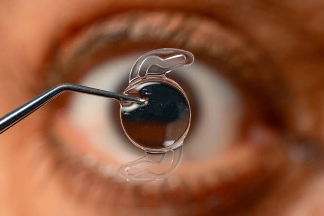 intraocular lens over eye