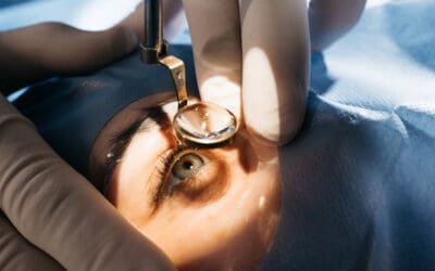 Advancements in Cataract Surgery That You Need To Know