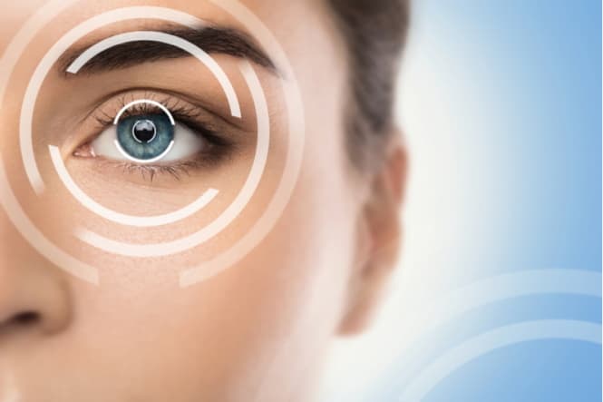 5 Things To Know About Refractive Lens Exchange